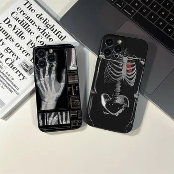 Radyolojik insan organları İskelet kafatası telefon kılıfı İÇİN iPhone 14 13 11 12 Pro 8 7 Artı X 13Pro MAX XS MİNİ SE 2020 siyah Kapakları