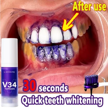 V34 Köpük 30ml Diş Temizleme Diş Macunu Etkili Diş Temizleme Beyazlatma Diş Macunu Azaltmak Sarı Kaldırmak Diş Leke Oral